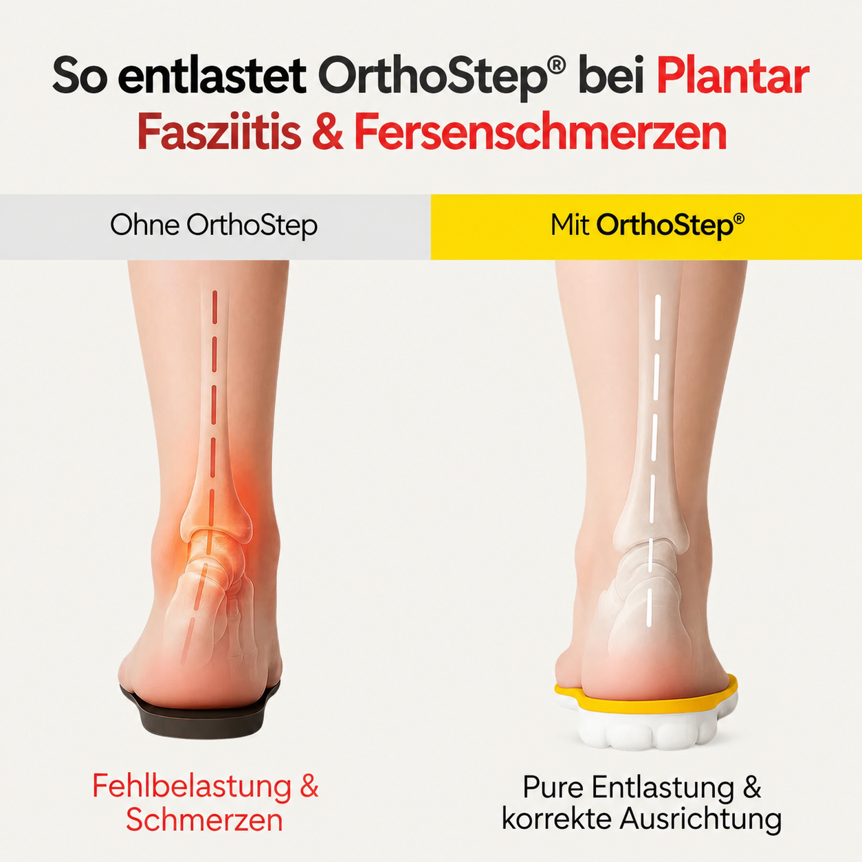 Entlastungssohlen bei Fersenschmerzen & Plantarfasziitis